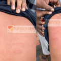 പാനൂരിനടുത്ത്  പൊയിലൂരിൽ പത്താം ക്ലാസ് വിദ്യാർത്ഥിനികളുടെ കൂടെ യാത്ര ചെയ്തതിന് അതേ  സ്കൂളിലെ  പത്താം ക്ലാസ് വിദ്യാർത്ഥികൾക്ക്  മർദ്ദനം ;  പരിക്ക്