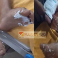 മട്ടന്നൂർ സബ്ജില്ല കായിക മേളക്കിടെ തലശേരി  സിന്തറ്റിക്ക് ട്രാക്കിൽ നിന്നും കുട്ടികൾക്ക് കാലിന്  പൊള്ളലേറ്റു ; 9 കുട്ടികൾക്ക് പരിക്ക് 