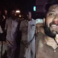 ഷാഫി പറമ്പില്‍ എംപിക്ക് പരിക്കേറ്റ സംഭവത്തില്‍ സംസ്ഥാന വ്യാപകമായി പ്രതിഷേധം