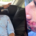 കാട്ടുപന്നി ആക്രമണത്തില്‍ വിദ്യാര്‍ത്ഥിക്ക് പരുക്ക്