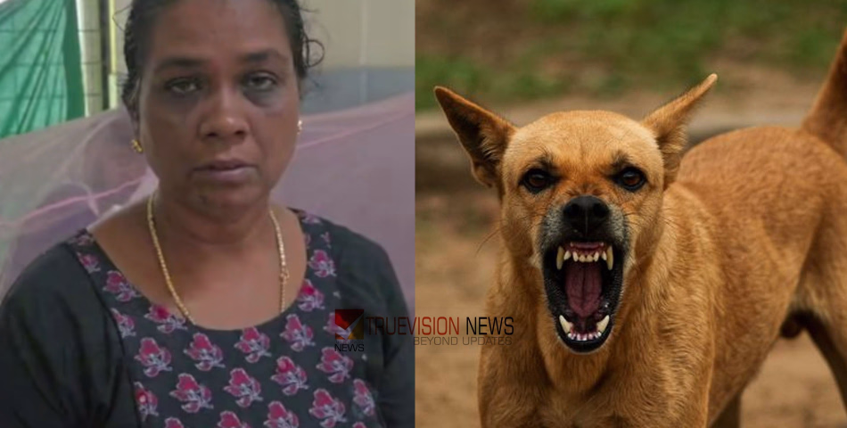 ഇവിടെയും രക്ഷയില്ല...!  പനി ബാധിതനായ മകനെ കാണാനെത്തിയ അമ്മയെ ആശുപത്രി വരാന്തയിൽ വെച്ച് തെരുവ് നായ കടിച്ചുപറിച്ചു 