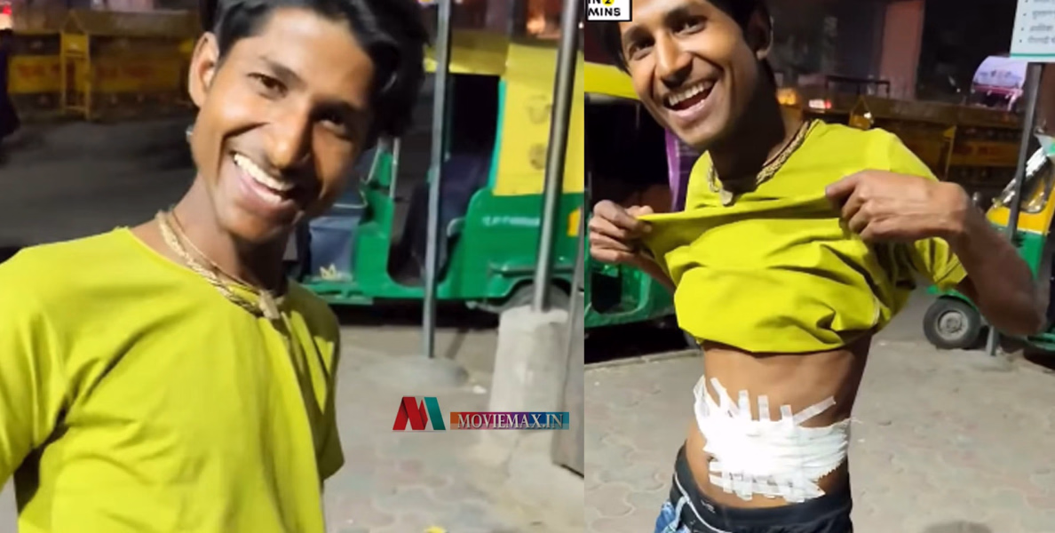 കാമുക ഹൃദയം കടന്ന കൈയ്യോ? കാമുകിക്ക് ഐ ഫോൺ വാങ്ങാൻ സ്വന്തം കഡ്നി വിറ്റ് കാശുണ്ടാക്കി യുവാവ്